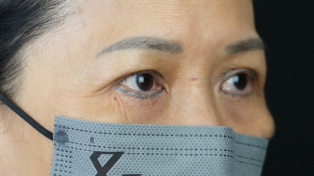 Postoperative Condition Part 1