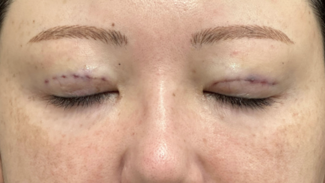 Postoperative Condition Part 1