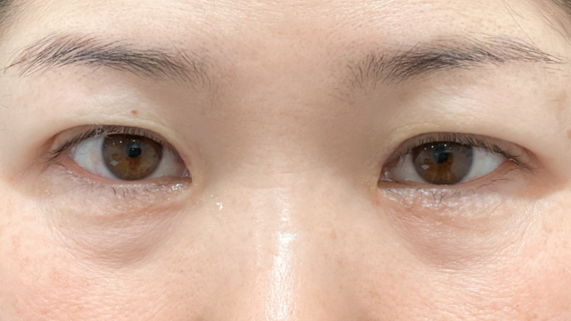 Postoperative Condition Part 1