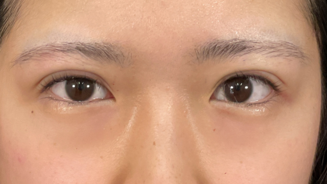 Postoperative Condition Part 1