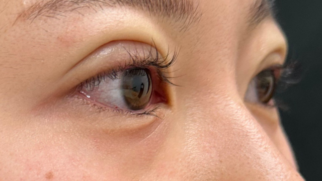 Postoperative Condition Part 1