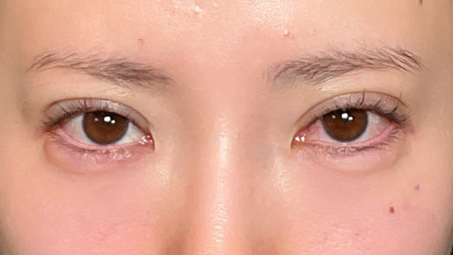 Postoperative Condition Part 1