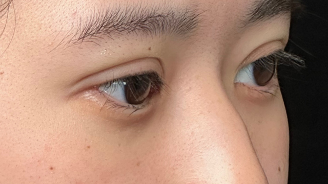 Postoperative Condition Part 1