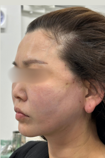 Postoperative Condition Part 1