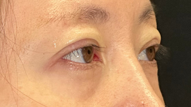 Postoperative Condition Part 1