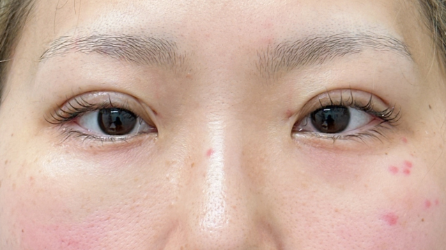 Postoperative Condition Part 1