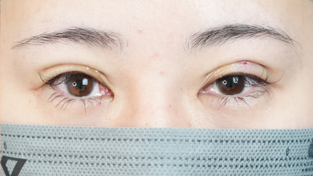 Postoperative Condition Part 1