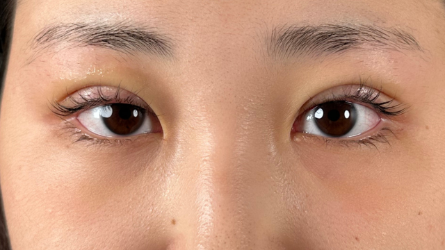 Postoperative Condition Part 1