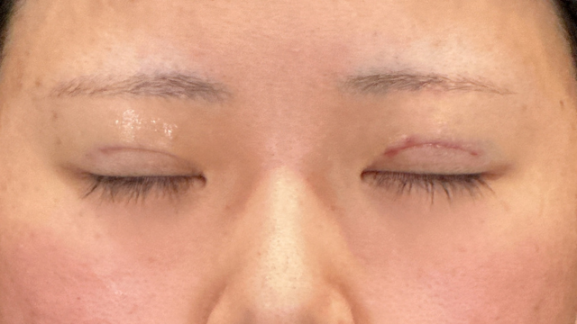 Postoperative Condition Part 1