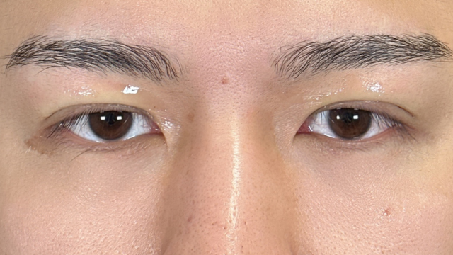 Postoperative Condition Part 1