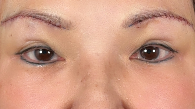 Postoperative Condition Part 1