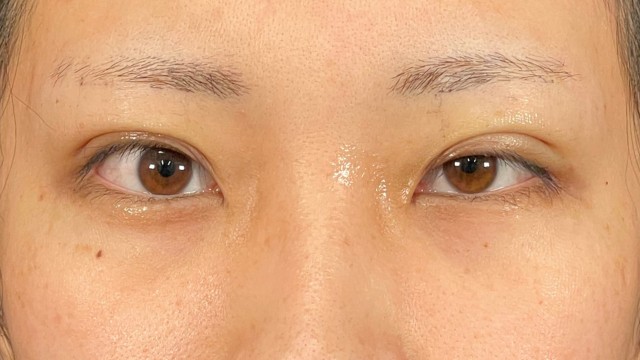 Postoperative Condition Part 1