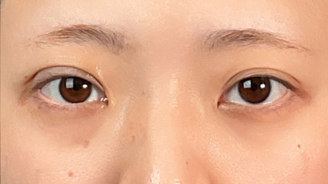 Postoperative Condition Part 1