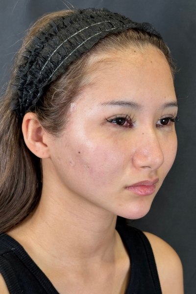 Postoperative Condition Part 1