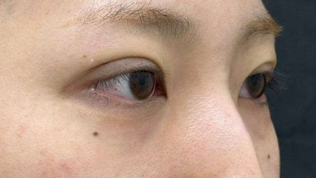 Postoperative Condition Part 1