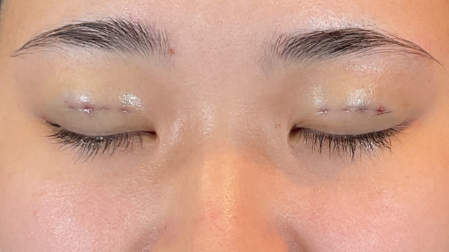 Postoperative Condition Part 1