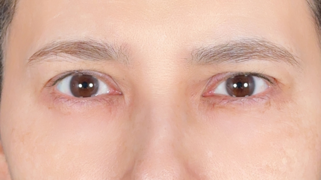 Postoperative Condition Part 1