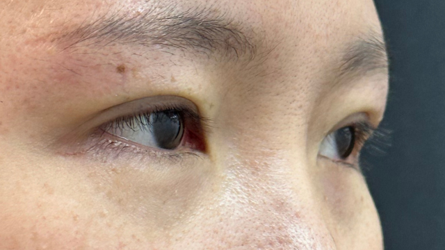 Postoperative Condition Part 1