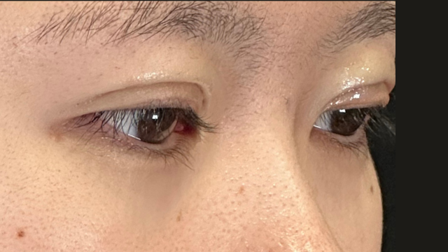 Postoperative Condition Part 1