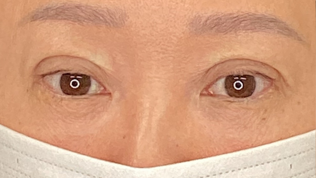 Postoperative Condition Part 1