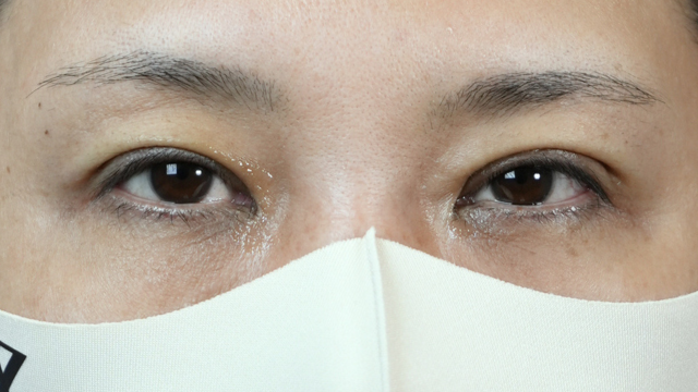 Postoperative Condition Part 1