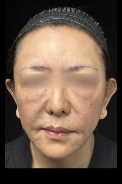 手術前の状態 その1