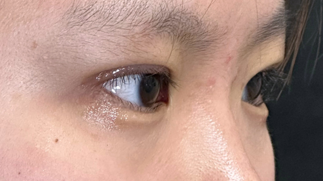 Postoperative Condition Part 1