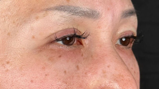 Postoperative Condition Part 1