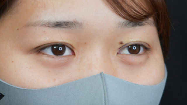 Postoperative Condition Part 1