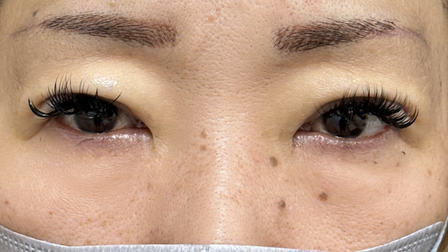 手术前的状态 其一