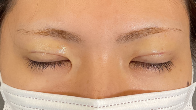 Postoperative Condition Part 1