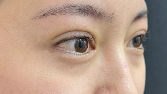 Postoperative Condition Part 1