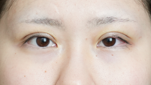 Postoperative Condition Part 1