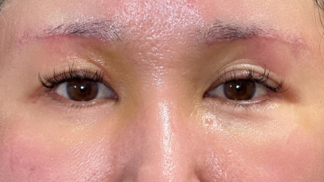 Postoperative Condition Part 1