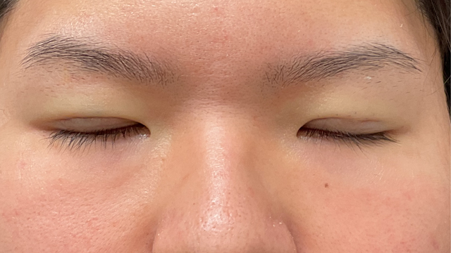 Postoperative Condition Part 1