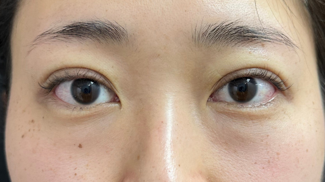 Postoperative Condition Part 1