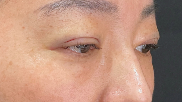 Postoperative Condition Part 1