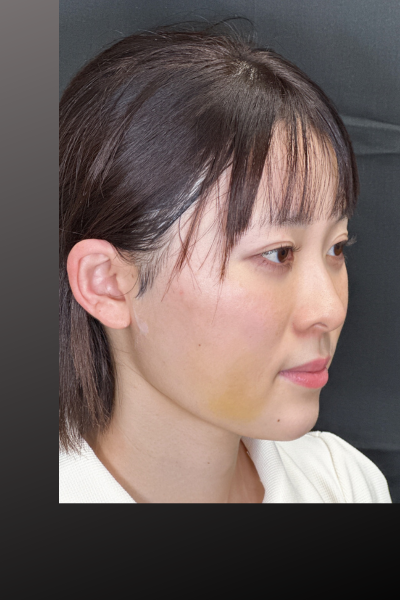 Postoperative Condition Part 1