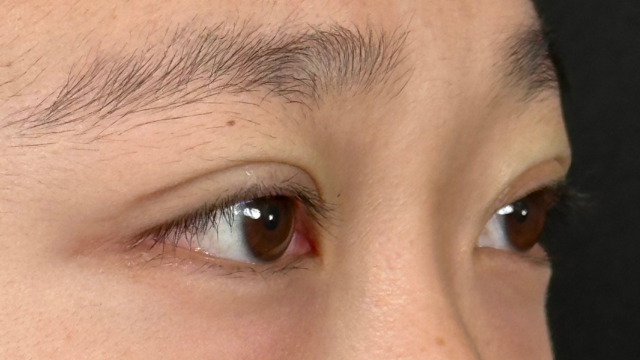 Postoperative Condition Part 1