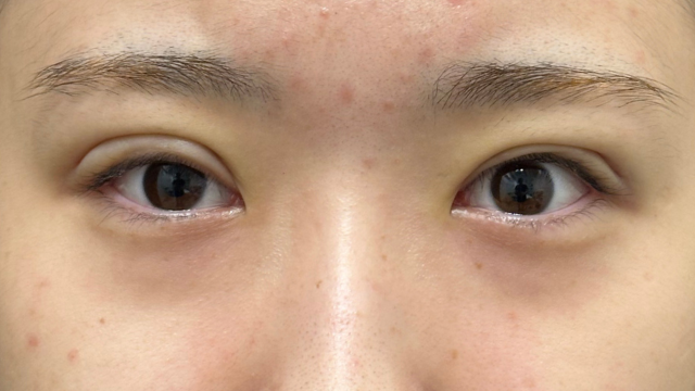 Postoperative Condition Part 1