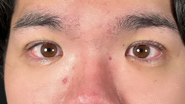 Postoperative Condition Part 1