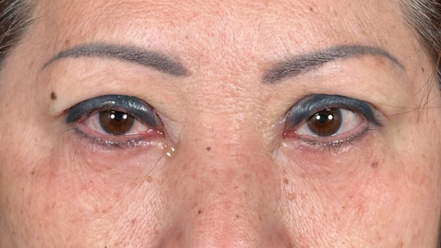 Postoperative Condition Part 1