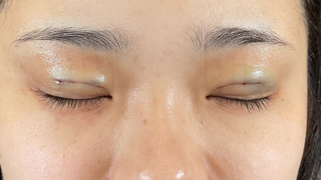 Postoperative Condition Part 1