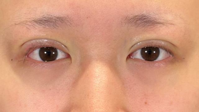 Postoperative Condition Part 1