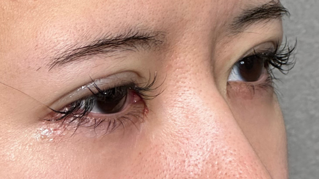 Postoperative Condition Part 1