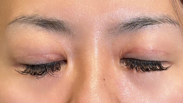 Postoperative Condition Part 1