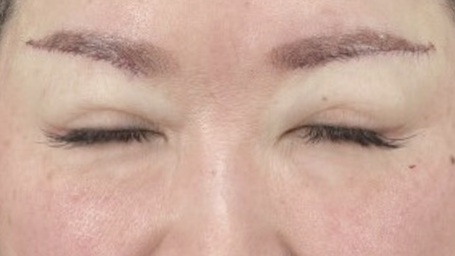 Postoperative Condition Part 1