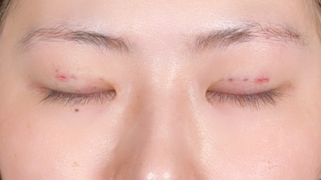 Postoperative Condition Part 1