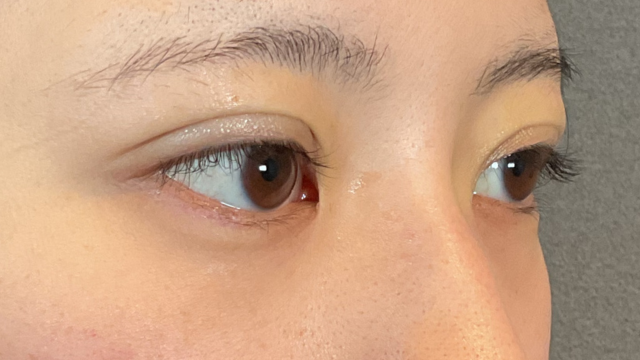 Postoperative Condition Part 1