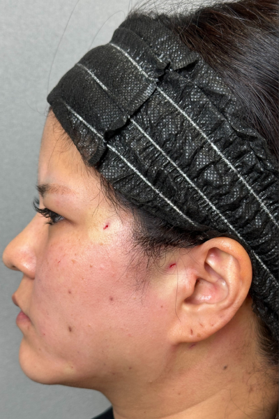 Postoperative Condition Part 1